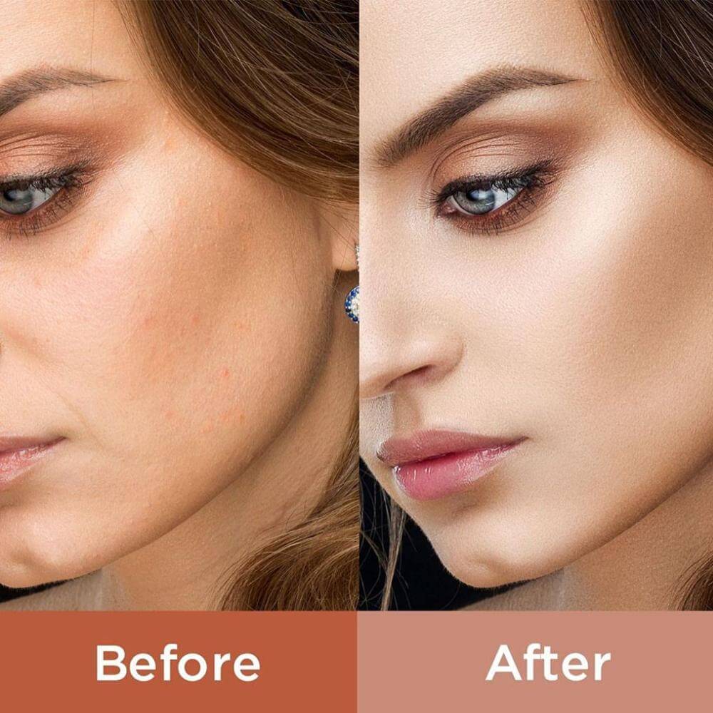 Before and after skin improvement using Platinum Gold Red Light Therapy for a radiant, balanced complexion.